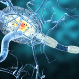 chiropratica sclerosi multipla parkinson